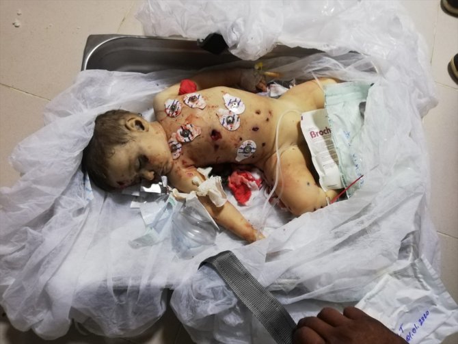 9 aylık Muhammed bebek YPG/PKK'nın kurbanı oldu