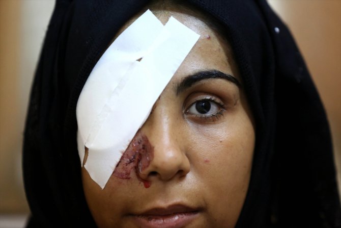 Filistinli genç kız, Gazze'deki Büyük Dönüş Yürüyüşü gösterilerinde gözünü kaybetti