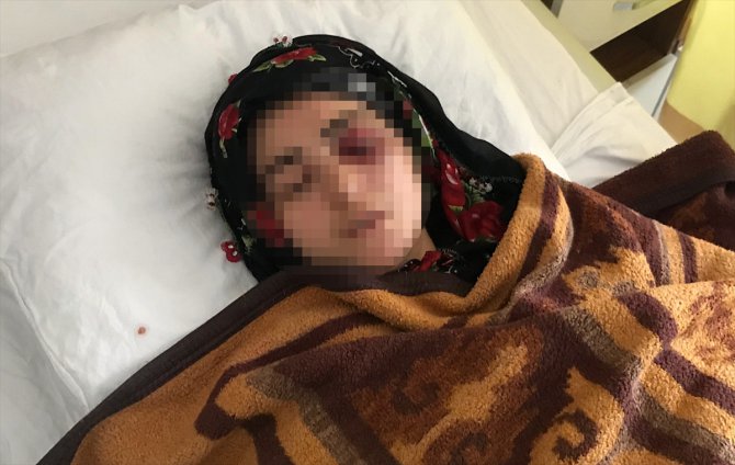Samsun'da eşi tarafından darbedilen kadının tedavisi sürüyor