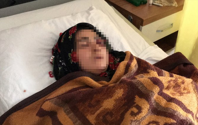 Samsun'da eşi tarafından darbedilen kadının tedavisi sürüyor