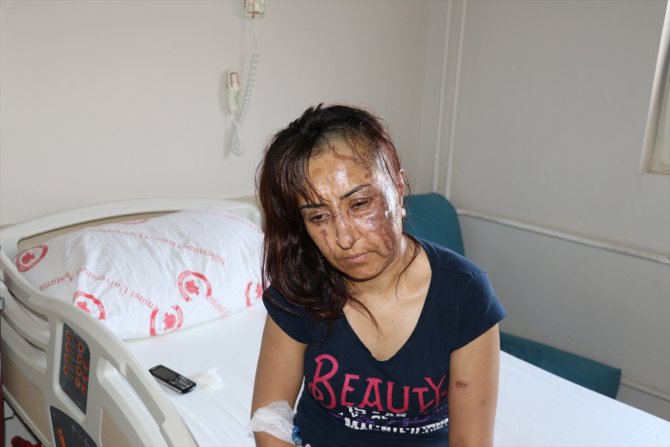 Boşanma davası açtığı kocasının kezzaplı saldırısına uğrayan kadın yaralandı