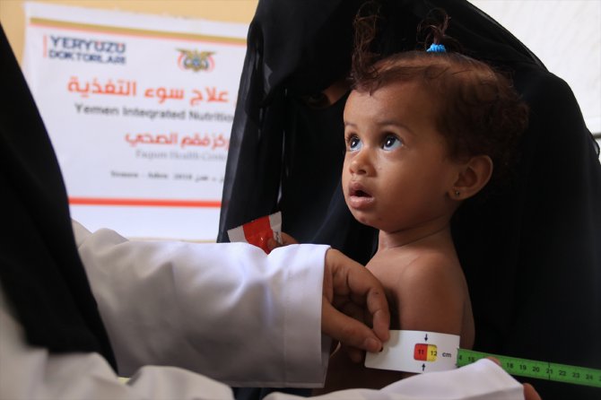 Yeryüzü Doktorları, Yemenli anne ve çocuklara özel beslenme programı uyguluyor