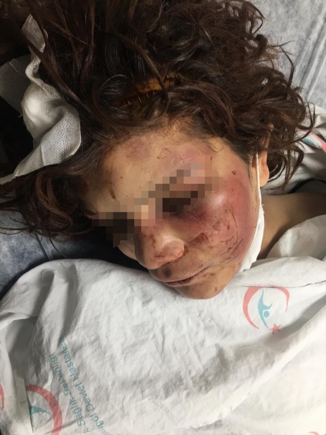 GÜNCELLEME 2 - Şanlıurfa'da birlikte yaşadığı kadına işkence ettiği iddia edilen kişi tutuklandı