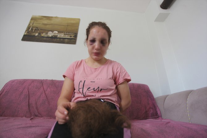 Aydın'da kocası tarafından darbedilen kadın şikayetçi oldu