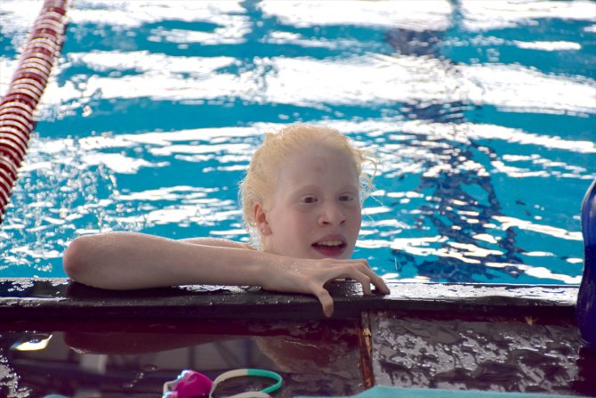 Albino yüzücü Ceren Yergezen, kulaçlarını Paralimpik Oyunları'na katılmak için atıyor