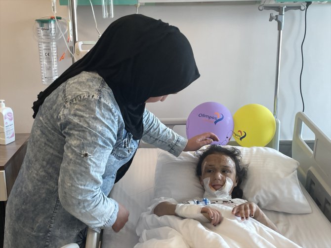 Vücudunun büyük bölümü yanan Iraklı 8 yaşındaki kıza Antalya'da estetik operasyon